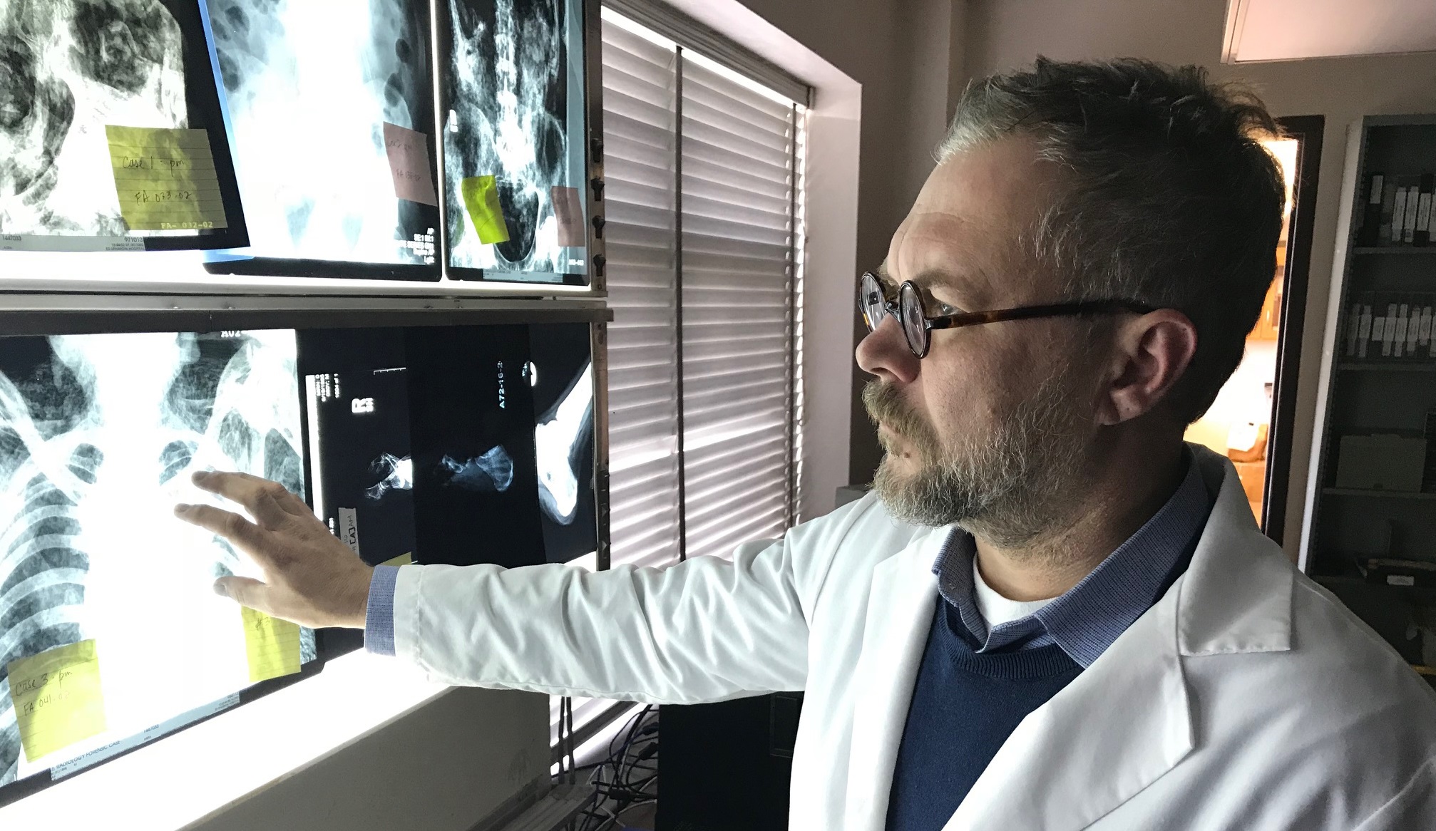 Dr. Joe Hefner looking at xrays